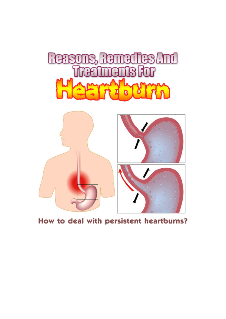 Reasons, Remedies, and Treatments for Heartburn PDF Download – Unknown Author
