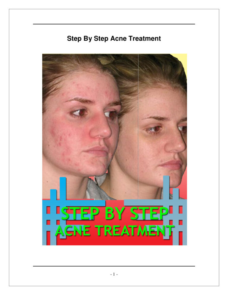 Step-by-Step Acne Treatment PDF Download – Unknown Author