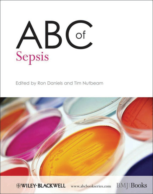 ABC of Sepsis PDF Download – Unknown Author