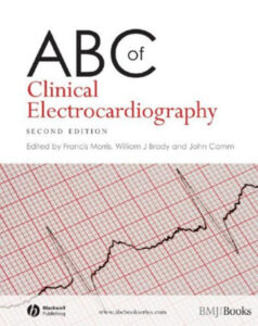 6884ad2308fc5 abc of clinical electrocardiography second edition by francis morris Kitap Kapağı
