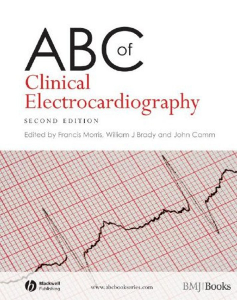 ABC of Clinical Electrocardiography PDF Download