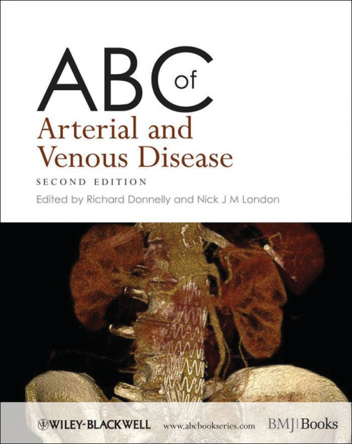 ABC of Arterial and Venous Disease PDF Download – Richard Donnelly