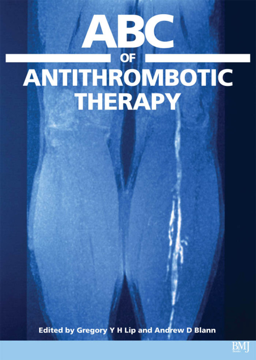 ABC of Antithrombotic Therapy PDF Download – Unknown Author
