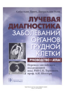 Лучевая диагностика заболеваний органов грудной клетки Russian Edition Себастьян Ланге Kitap Kapağı