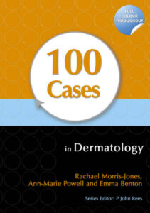 100 Cases in Dermatology Rachael Morris Jones Ann Marie Powell etc Kitap Kapağı