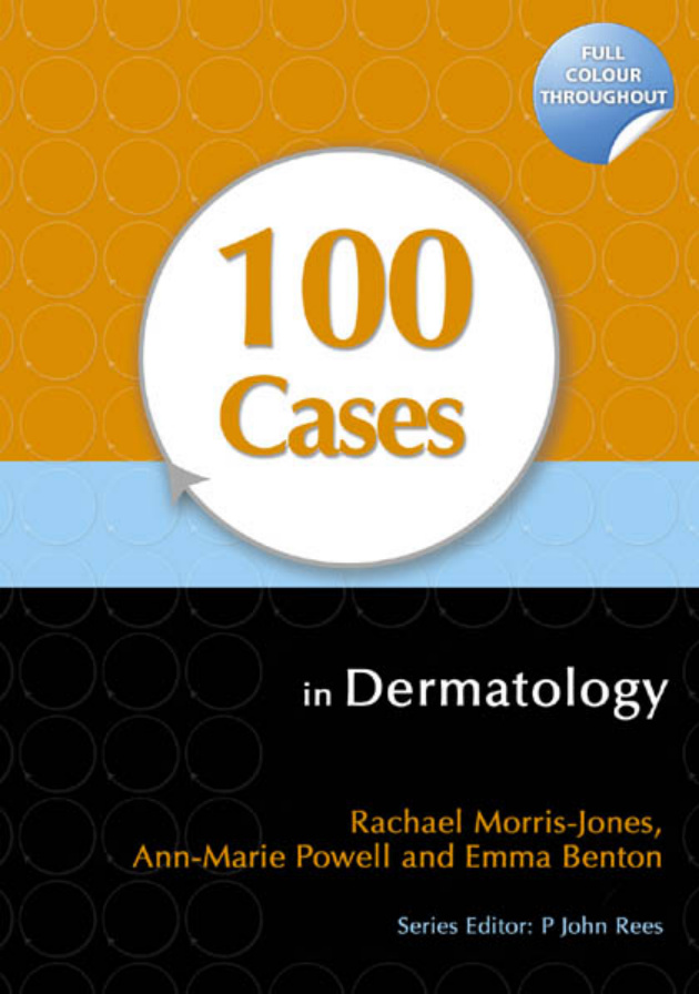 100 Cases in Dermatology Rachael Morris Jones Ann Marie Powell etc Kitap Kapağı