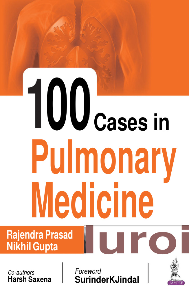 100 Cases in Pulmonary Medicine Rajendra Prasad, Nikhil Gupta, Harsh Kitap Kapağı