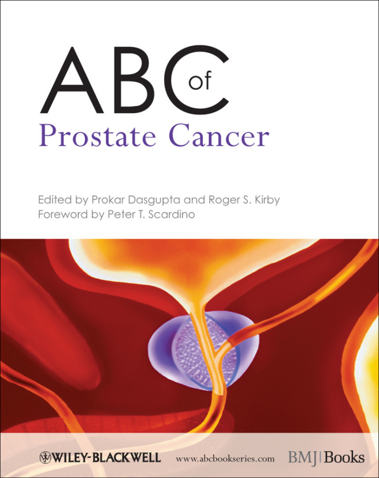 ABC of Prostate Cancer PDF Download