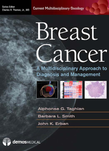 Breast Cancer A Multidisciplinary Approach to Diagnosis and Managmenet Kitap Kapağı