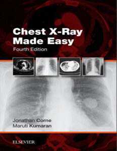 Chest X Ray Made Easy Jonathan Corne, Maruti K Z Library Kitap Kapağı