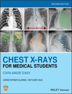 Chest X Rays for Medical Students Christopher Clarke Anthony Dux Kitap Kapağı