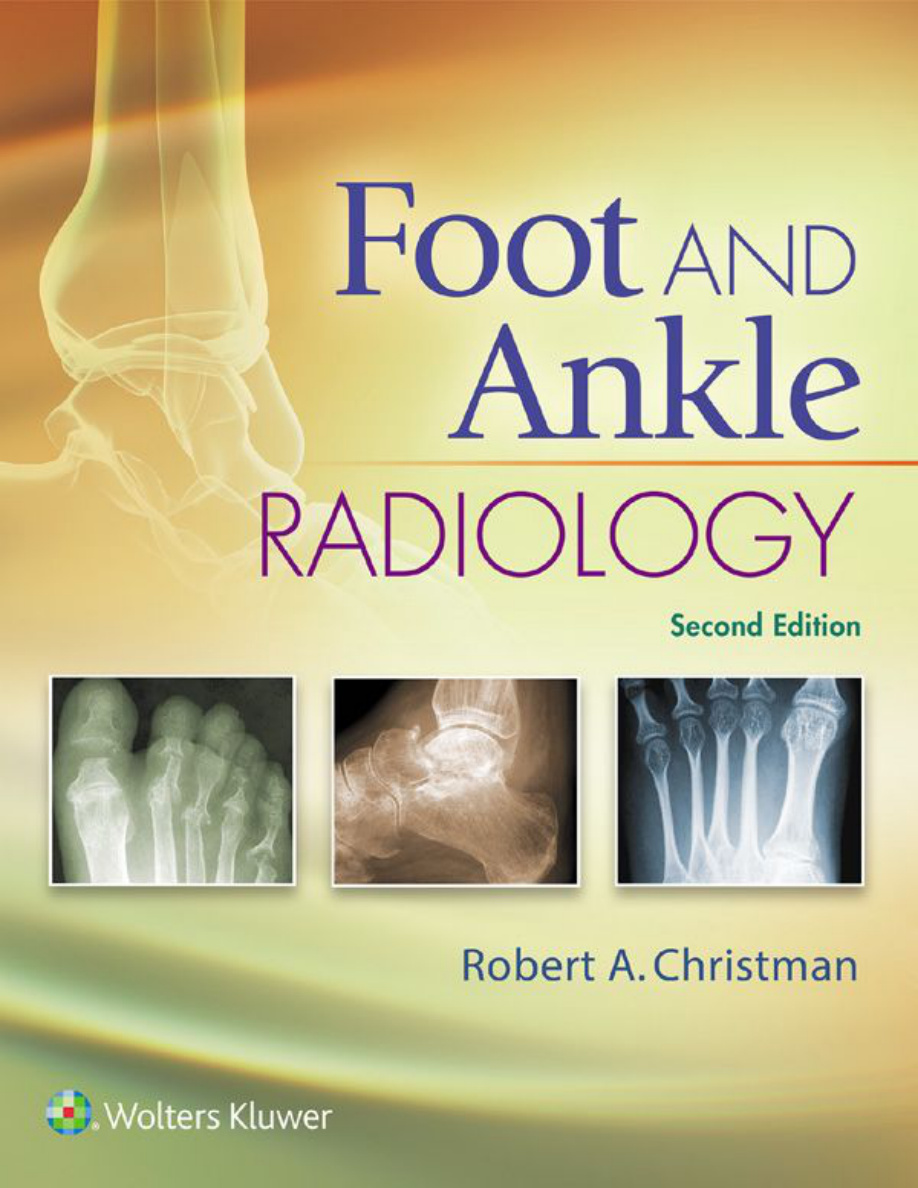 Foot and ankle radiology PDF Download