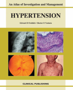 Hypertension An Atlas of Investigation and Management Edward D Frohlich Kitap Kapağı