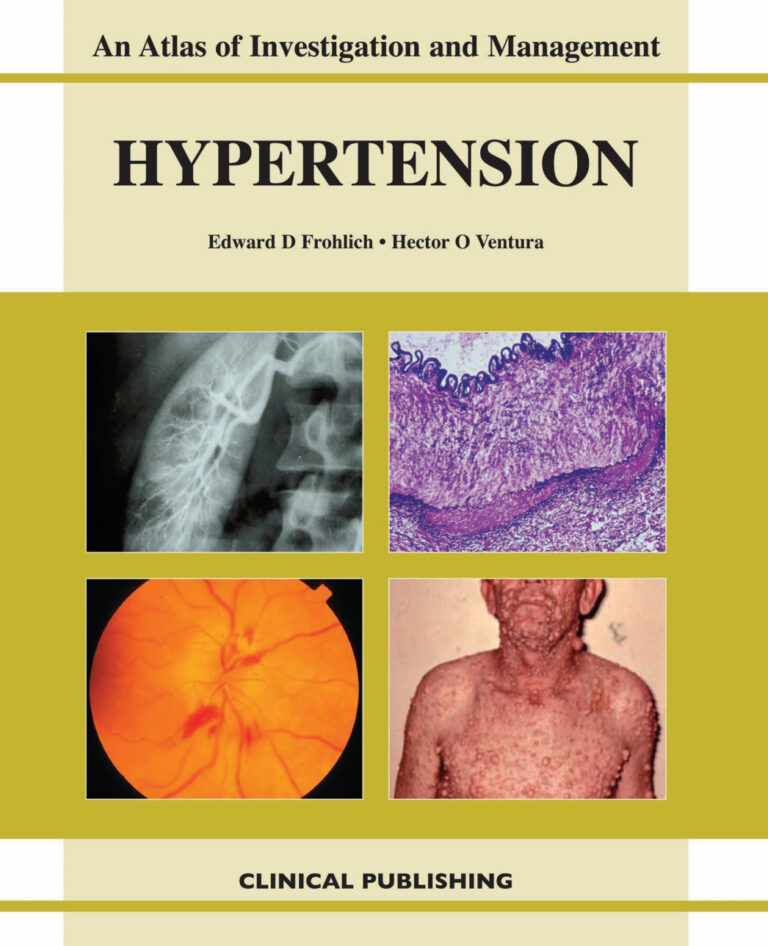 Hypertension An Atlas of Investigation and Management Edward D Frohlich Kitap Kapağı