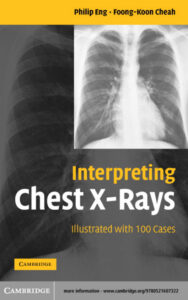 Interpreting chest x rays illustrated with 100 cases Philip Eng Kitap Kapağı