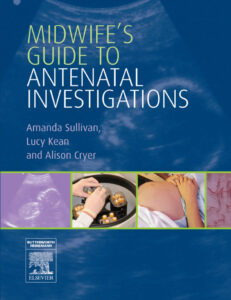 Midwifes guide to antenatal investigations edited by Amanda Sullivan Kitap Kapağı