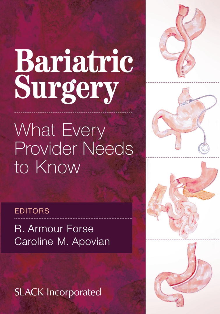 Bariatric Surgery What Every Provider Needs to Know R Armour Forse Kitap Kapağı