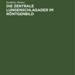 Die zentrale Lungenschlagader im Rontgenbild German Edition Karlheinz Richter Kitap Kapağı