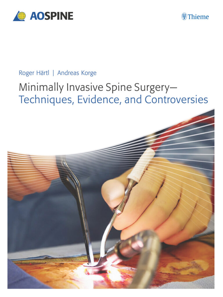 Minimally Invasive Spine Surgery Roger Haertl Andreas Korge Kitap Kapağı