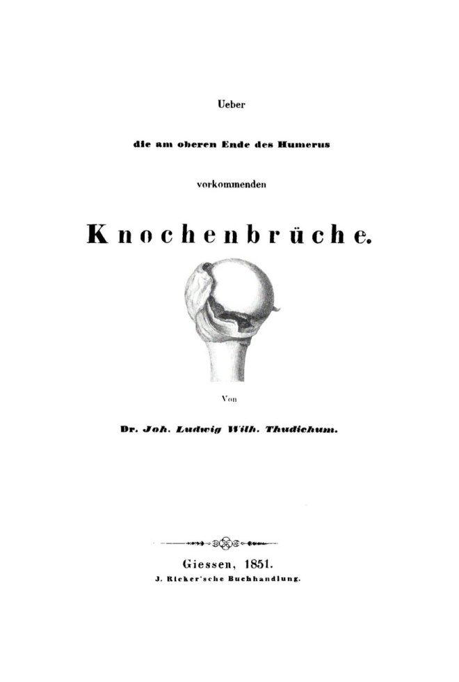 Ueber die am oberen Ende des Humerus vorkommenden Knochenbruche German Edition Joh Ludwig Wilh Thudichum Kitap Kapağı