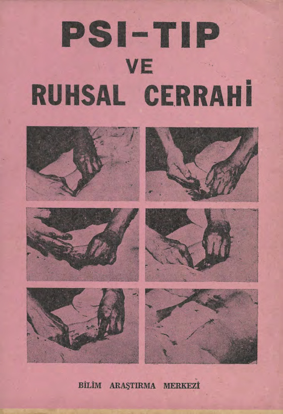 Psi-Tıp ve Ruhsal Cerrahi PDF - Bilim Araştırma Merkezi 9 Psi-Tıp ve Ruhsal Cerrahi PDF – Bilim Araştırma Merkezi